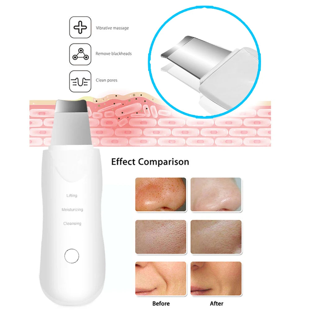 Ultrasonic Face Skin Scrubber